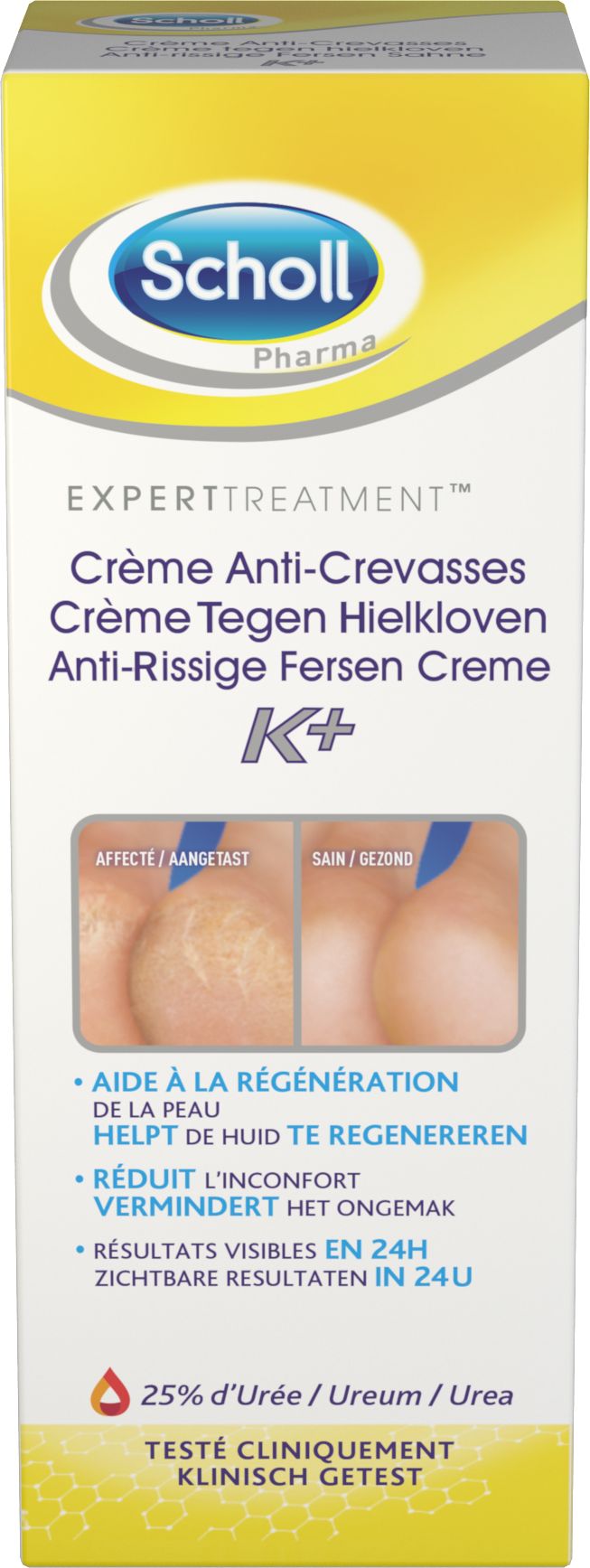 Scholl Crème Tegen Hielkloven 60 ml - Scholl